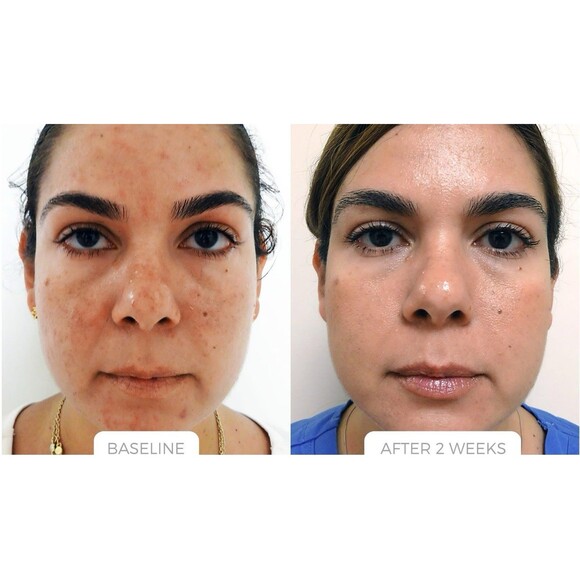 NEW LunaMD Multi-Complex Night Cream 1.7oz Anti Aging Moisturizer Hydration Lift - Picture 14 of 14